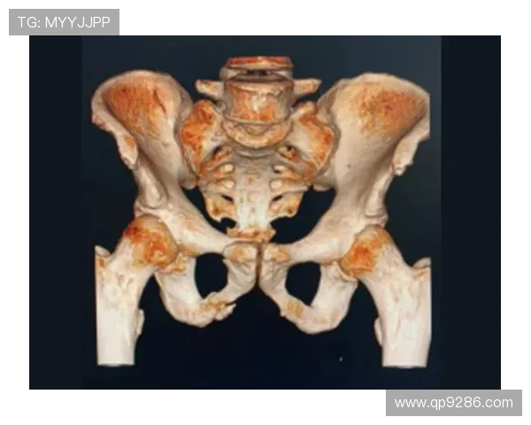 伊尼亚基称尼科耻骨伤未愈困扰中